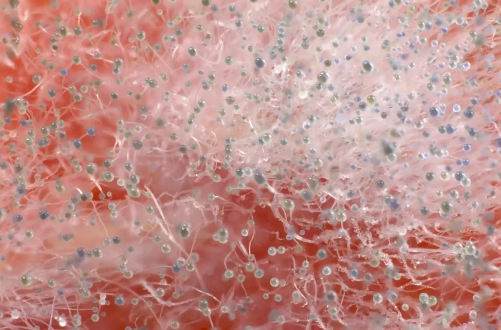 پوسیدگی موکور - آریامی